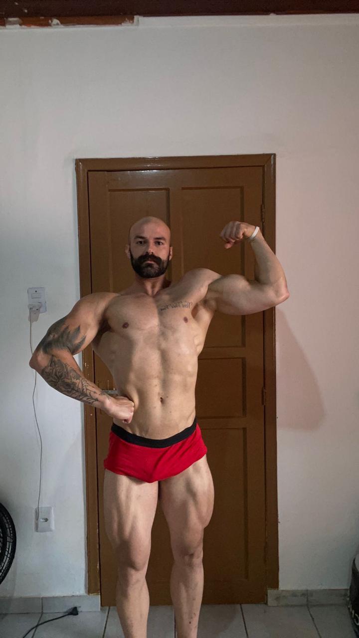 Depois — caso Hipertrofia